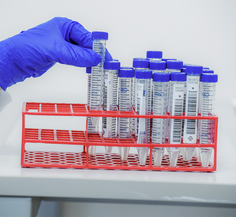 Solvent-resistant labels streamline management of pathology tests