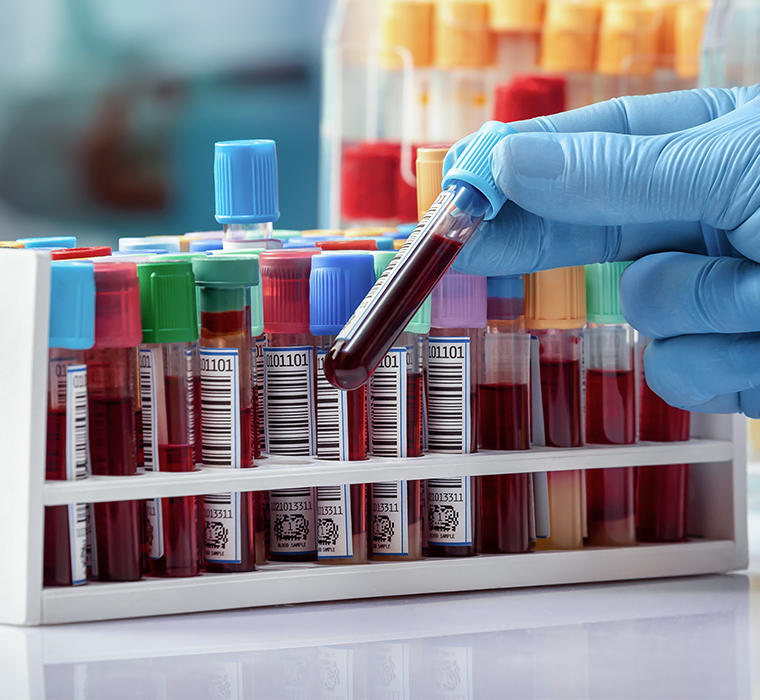 Accurately label specimens